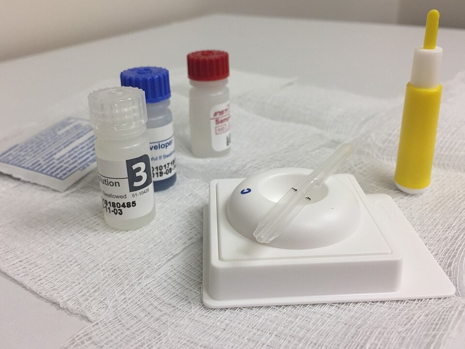 Impact of US Funding Cuts on HIV Response in Africa