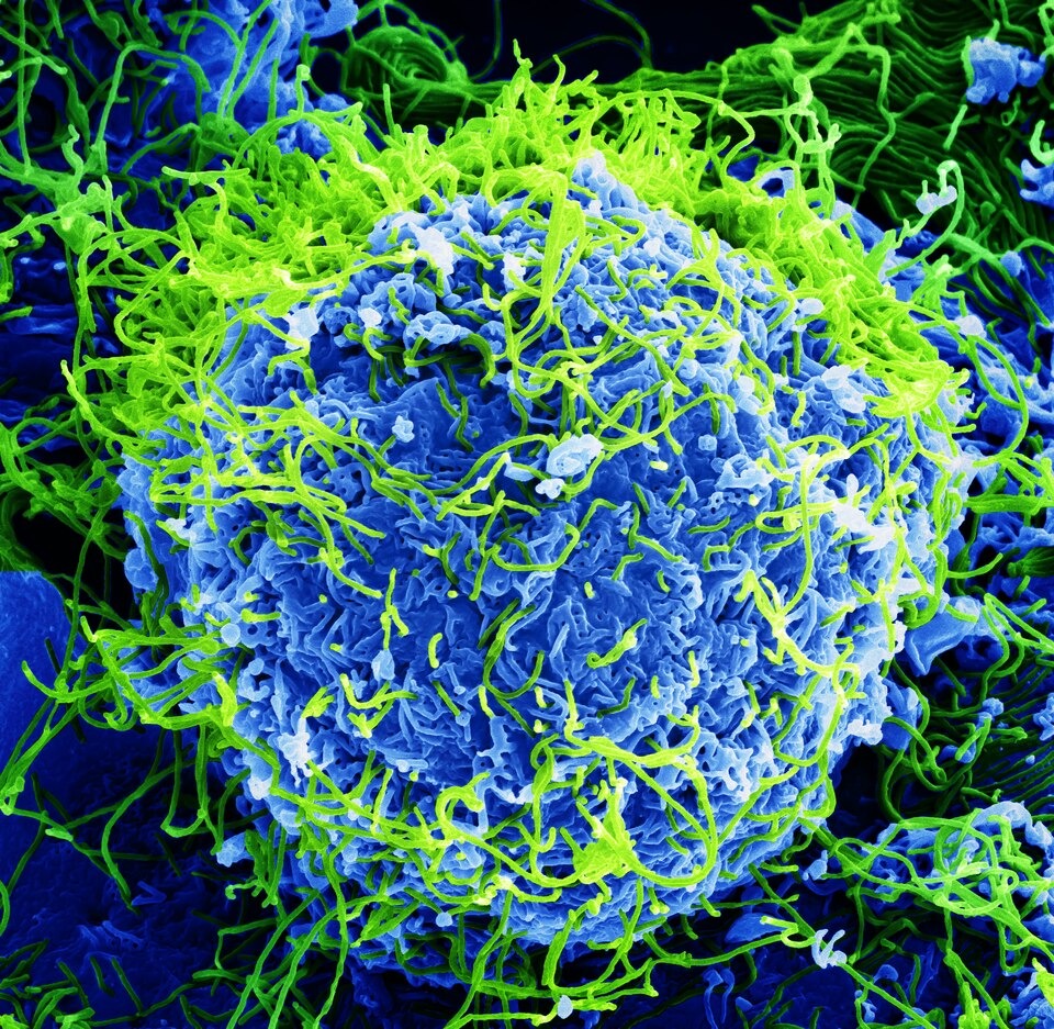 New Ebola Outbreak Hits DR Congo Mining Region and Bunia, 65 Dead