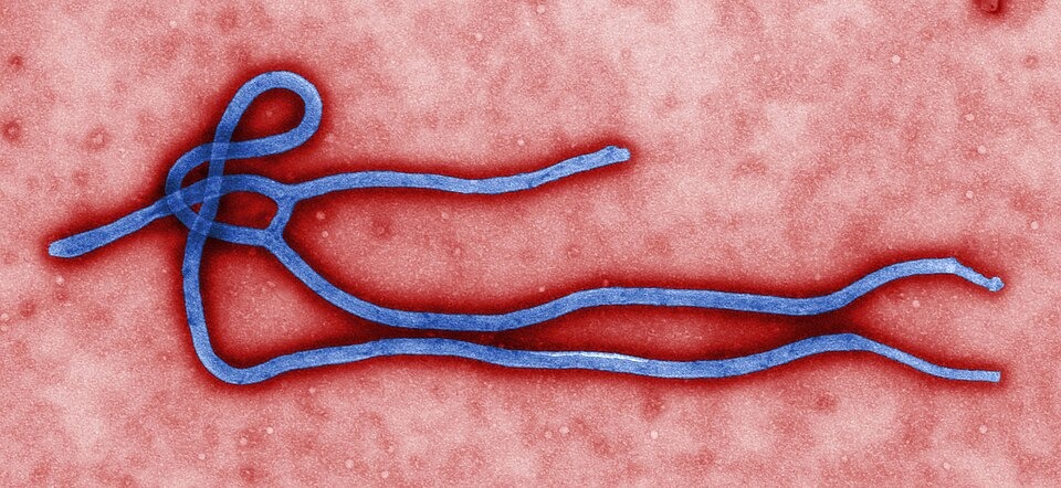 Ebola Outbreak Spreads in DR Congo’s Ituri Province Amid Rising Fears