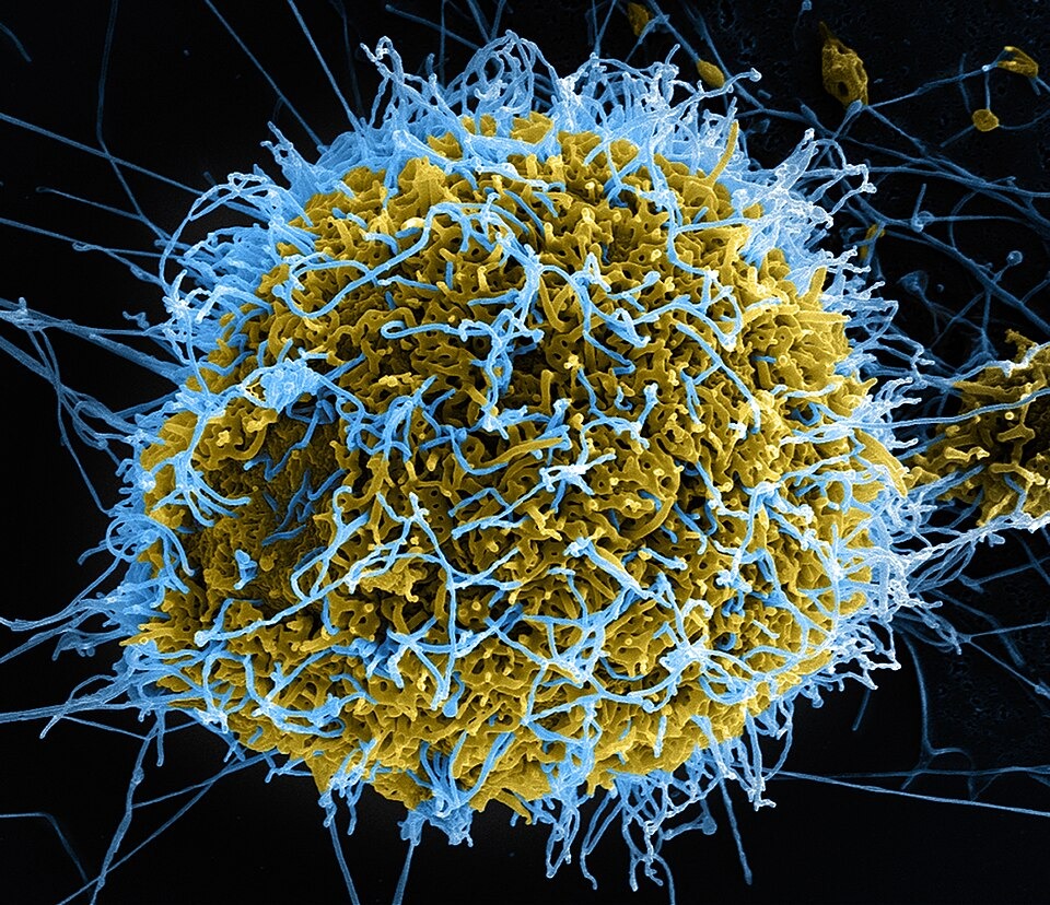 WHO Says Conflict and Bombings Hampering Ebola Response Efforts